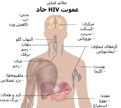 ویروس ایدز-ایدز-علایم ایدز