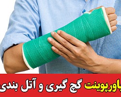 آتل بندی,گچ گیری و آتل بندی,روش های گچ گیری,کتاب گچ گیری و آتل بندی,پاورپوینت گچ چیری و آتل بندی در شکستگی