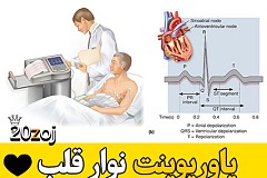 الکتروکاردیوگرام,نوار قلب,آموزش دستگاه قلب