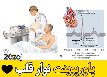 الکتروکاردیوگرام,نوار قلب,آموزش دستگاه قلب